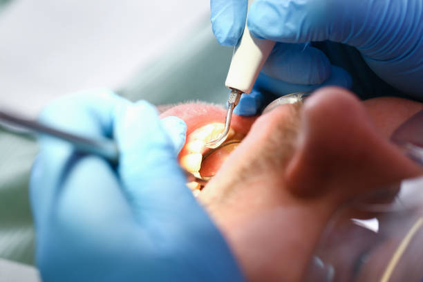 Best Emergency Dentist for Special Needs Patients in Evansville, IN